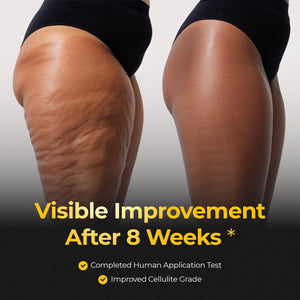 calo EMS Slim Maker Pro Set - calo