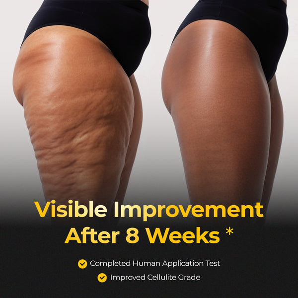 calo EMS Slim Maker Pro Set - calo